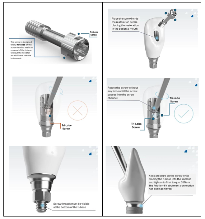 Plaatsingsprocedure GenTek ASC ti-base