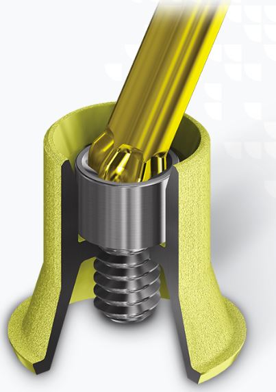 Universal Angulated Screw Channel TiBase